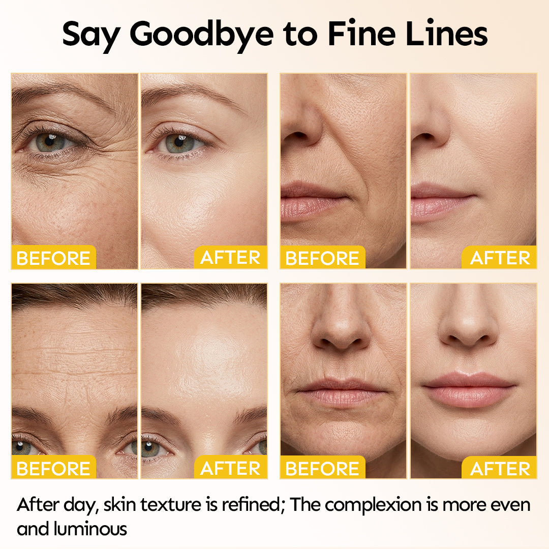 Renew & Hydration Fine Line Smoothing Essence Set